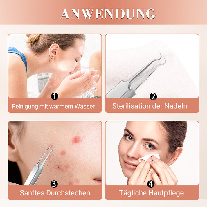 ✨ Profi Poren-Reinigungs-Set (7-tlg) – Für makellose, reine Haut